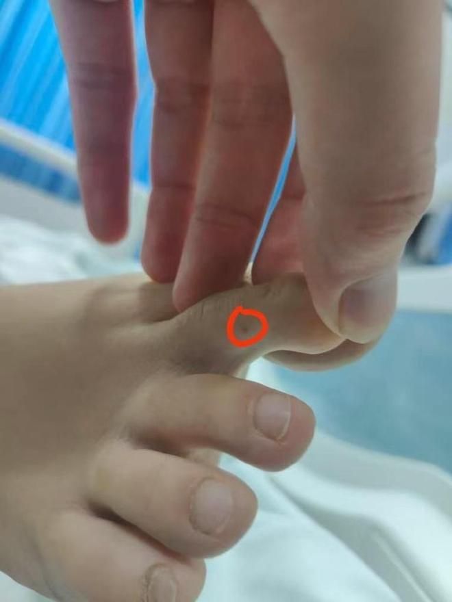九游体育：27岁女游客三亚被蛇咬身亡专家急吼：秒拍蛇照是救命关键(图1)